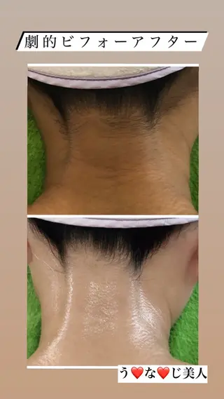 美肌脱毛fuu okinawa所属・宜野湾美肌脱毛fuu okinawaタイラのエステ・リラクイメージ