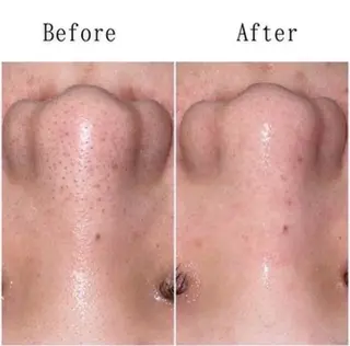 大塚 瀬奈のマツエク・マツパデザイン