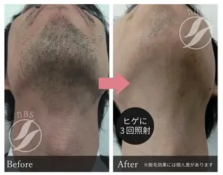 メンズ ARME 浅見のエステ・リラクイメージ