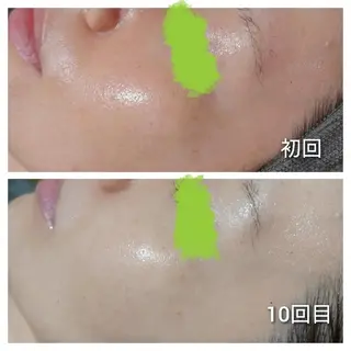 Luanaまつパ脱毛 ハーブピーリング眉毛のマツエク・マツパデザイン