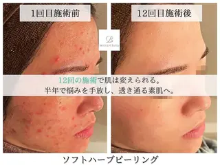 韓国肌管理Belle志木店所属・中谷 彩華のエステ・リラクイメージ