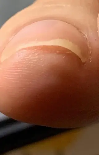 carenail　 tsugumiのその他イメージ