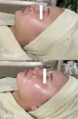 エステサロン Mi-mi.iのエステ・リラクイメージ