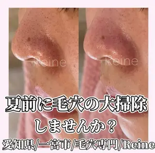 毛穴/シミ肝斑/脱毛 横山梨里のエステ・リラクイメージ