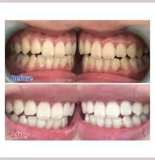 M渋谷 ホワイトニングのエステ・リラクイメージ