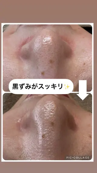 W MISATOのエステ・リラクイメージ