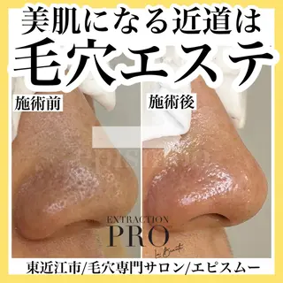 メンズ epismoo 脱毛/HBL/毛穴の眉毛・アイブロウイメージ