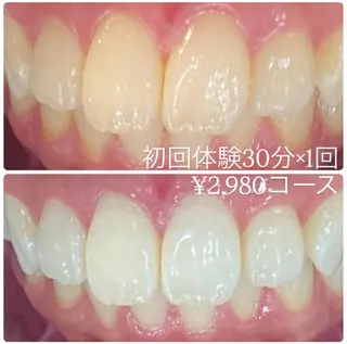 ホワイトニングルーム 横浜店のその他イメージ