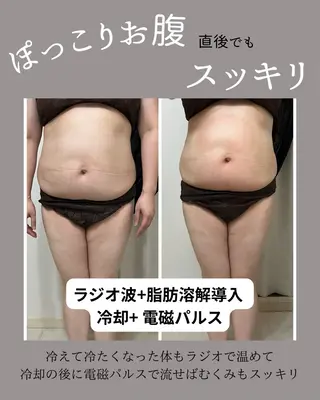 【脂肪冷却痩身サロン】una.福岡所属・UNA 福岡のエステ・リラクイメージ