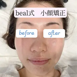 小顔/毛穴/ニキビ salon bealのエステ・リラクイメージ