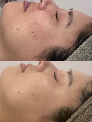 MELIA the beauty所属・肌のお悩み改善サロン MELIA/朋美のエステ・リラクイメージ