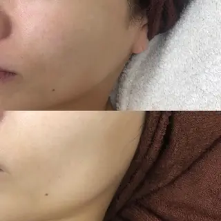 Ｍ渋谷 ホワイトニングのエステ・リラクイメージ