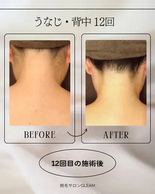 GLEAM所属・都度払い脱毛サロン GLEAM 桜井市のエステ・リラクイメージ