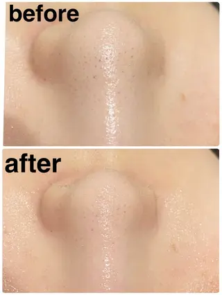 Beauty Salon Lunaのエステ・リラクイメージ