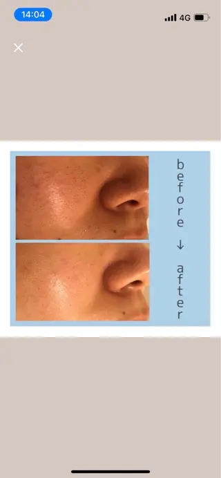 ポーラ梅田太融寺店所属・POLA 梅田太融寺店のエステ・リラクイメージ