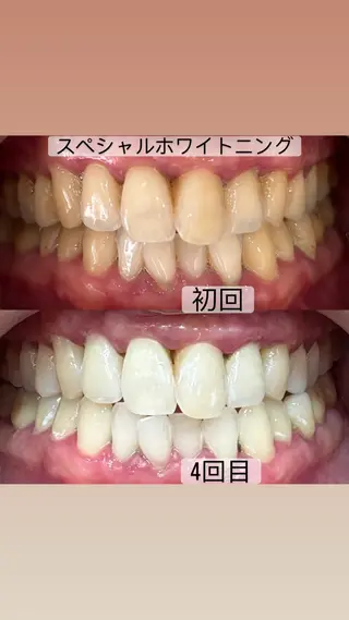 ホワイトニングサロン yatto.のその他イメージ