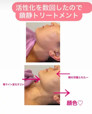 🅖🅤🅩🅔🅛 salonのエステ・リラクイメージ