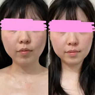 骨格美容整体 bimote.新宿のエステ・リラクイメージ