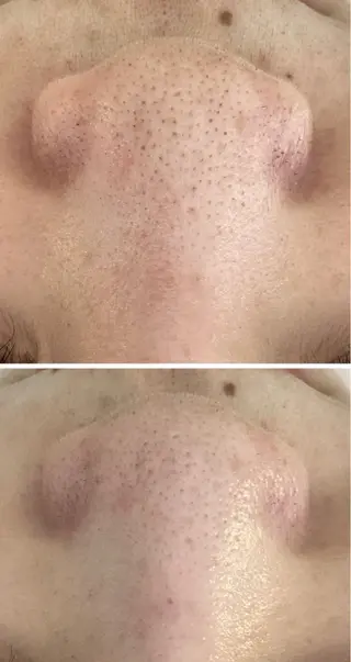 メンズ NAIL Salon Charmeのエステ・リラクイメージ