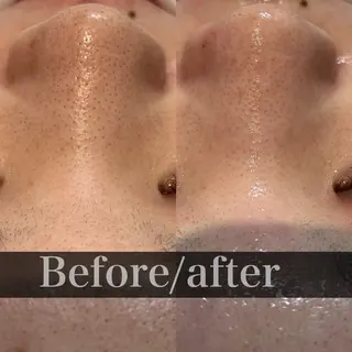 FOXYLASH inoueのエステ・リラクイメージ