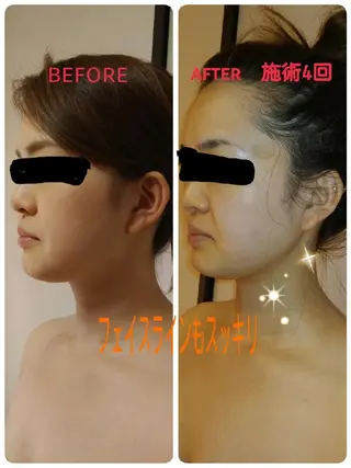 リンパサロン レディ ワンのエステ・リラクイメージ