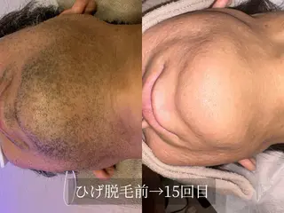 脱毛サロン Arumのエステ・リラクイメージ