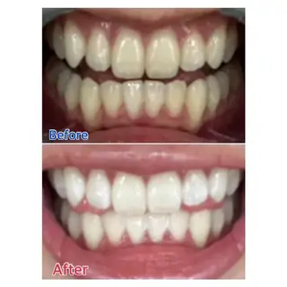 M渋谷 ホワイトニングのエステ・リラクイメージ