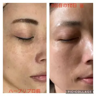 山元 光絵のエステ・リラクイメージ