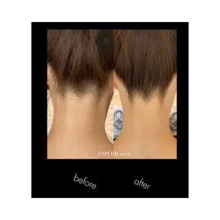 ワックス脱毛🌈 ESPOIRnocoのエステ・リラクイメージ