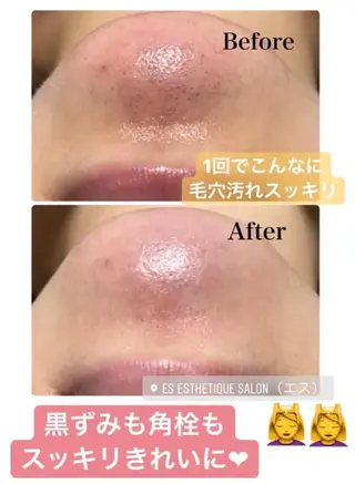 Mano Amikaのエステ・リラクイメージ