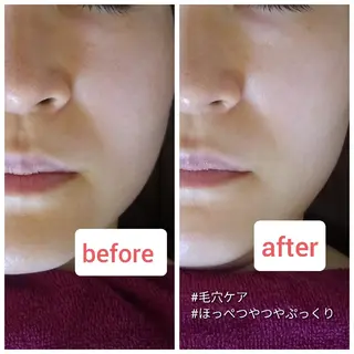 Melocoton （メロコトン）のエステ・リラクイメージ
