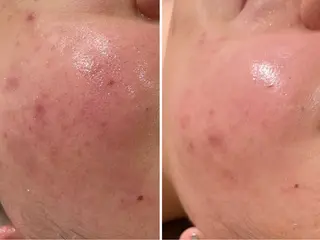 イデアルMe ♡のその他イメージ