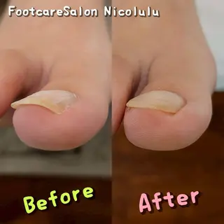 足トラブル専門 ニコルル金沢のエステ・リラクイメージ