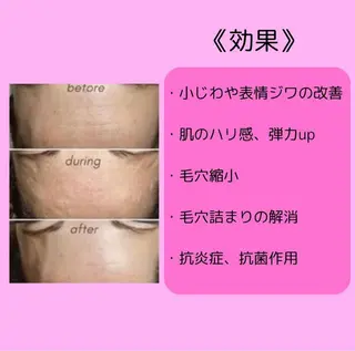 Lily luce 美骨小顔矯正のその他イメージ