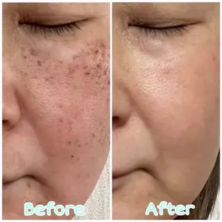 moe beauty salon所属・moe sayuriのエステ・リラクイメージ