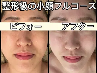 小顔専門看護師クリニカルサロンCOCO所属・小顔と美肌サロン クリニカルサロンココのエステ・リラクイメージ