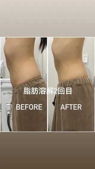 毛穴洗浄・痩身・脱毛 /アルカンジュのエステ・リラクイメージ