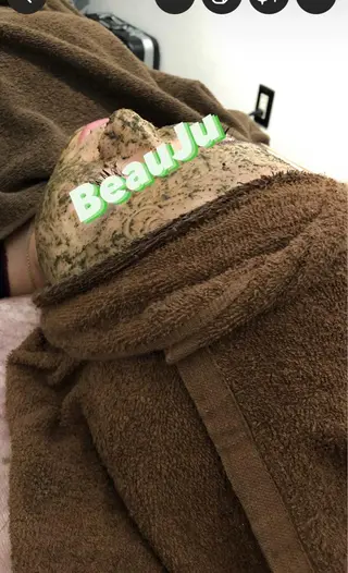 小顔矯/美容鍼/鍼灸 BeauJuのその他イメージ