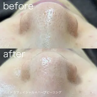 lulularico Yuのエステ・リラクイメージ