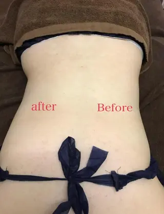 調律エステ /美KISSのその他イメージ