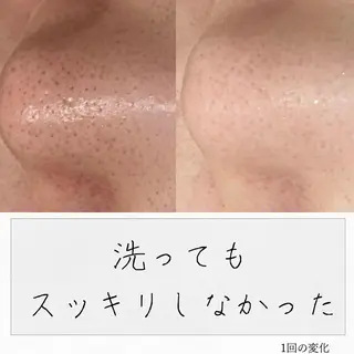 ニキビ経験者が施術 する専門サロン🌻のエステ・リラクイメージ