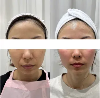 毛穴に特化したサロン MYFAIRLADYのエステ・リラクイメージ