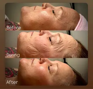 艶肌ワックス ALLY.のエステ・リラクイメージ