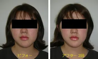 吉信 　のエステ・リラクイメージ