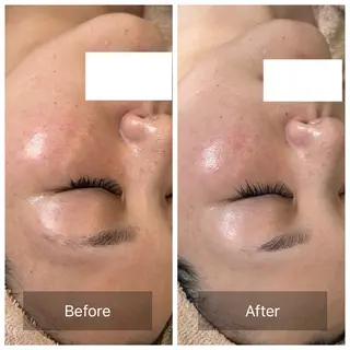 facial aesthetic salon SENTEUR所属・美肌改善/毛穴/シミ サントゥールのエステ・リラクイメージ