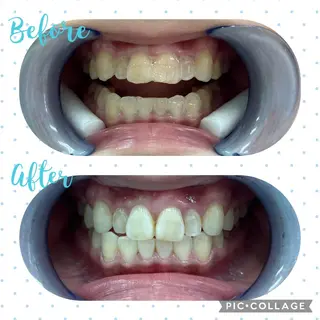 セルフホワイトニング COCOSHIROのエステ・リラクイメージ