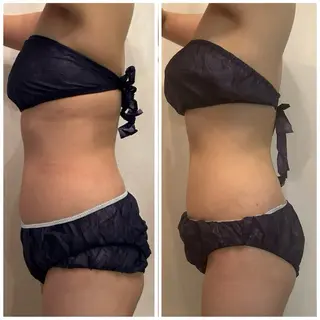 アプローズ所属・恵比寿/小顔/痩身 アプローズのエステ・リラクイメージ