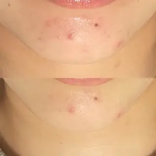 フェイシャル専門店　regalo所属・フェイシャル専門店 regaloのエステ・リラクイメージ