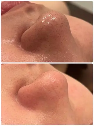 salon La•Junavie所属・[毛穴•肌質改善] フェイシャル専門のエステ・リラクイメージ