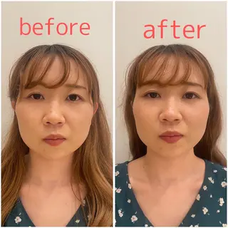 🌸美容鍼サロン🌸 メゾンブランシェ🌈のエステ・リラクイメージ